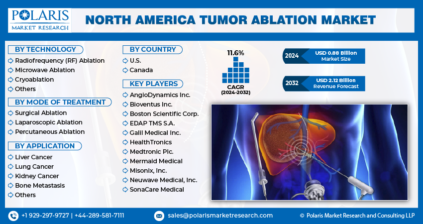 North America Tumor Ablation Market Size